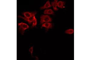 Image no. 1 for anti-Mitogen-Activated Protein Kinase Kinase Kinase 5 (MAP3K5) (pSer83) antibody (ABIN6256431)
