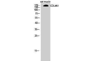 Image no. 1 for anti-Collagen, Type IV, alpha 1 (COL4A1) (N-Term) antibody (ABIN3184012)