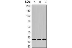 Image no. 1 for anti-Aldo-Keto Reductase Family 1, Member C3 (3-alpha Hydroxysteroid Dehydrogenase, Type II) (AKR1C3) (full length) antibody (ABIN6043146)