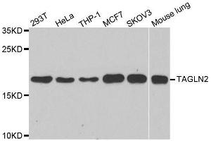 Image no. 1 for anti-Transgelin 2 (TAGLN2) antibody (ABIN6148831)