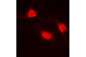 Immunofluorescent analysis of Beta-catenin staining in HeLa cells.