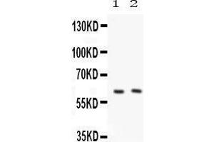 Image no. 1 for anti-Pyruvate Kinase, Liver and RBC (PKLR) (AA 522-552), (C-Term) antibody (ABIN3043607)