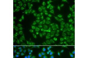 Immunofluorescence analysis of A549 cells using MAP4K3 Polyclonal Antibody
