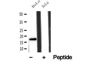 Western blot analysis of extracts of HeLa cells, using FIS1 antibody.