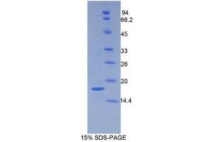 Image no. 1 for Periostin (POSTN) (AA 500-630) protein (His tag) (ABIN1080493)