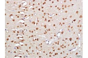 Image no. 1 for anti-Heterogeneous Nuclear Ribonucleoprotein M (HNRNPM) antibody (ABIN1385729)