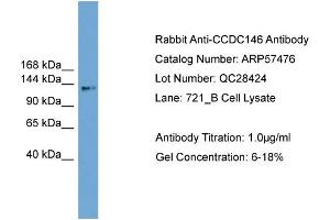 Image no. 2 for anti-Coiled-Coil Domain Containing 146 (CCDC146) (Middle Region) antibody (ABIN2787239)