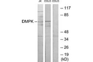 Image no. 1 for anti-Dystrophia Myotonica-Protein Kinase (DMPK) (AA 11-60) antibody (ABIN1533843)