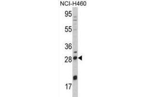Image no. 1 for anti-Nerve Growth Factor beta (NGFB) antibody (ABIN3003483)