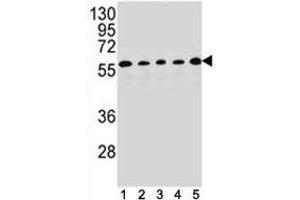 Image no. 3 for anti-Paired Box 1 (PAX1) (AA 443-471) antibody (ABIN3028910)