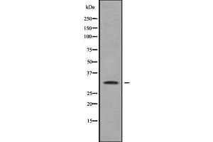 Image no. 1 for anti-RAB40A, Member RAS Oncogene Family (RAB40A) antibody (ABIN6264580)
