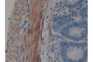 Image no. 3 for anti-WNT Inhibitory Factor 1 (WIF1) (AA 38-247) antibody (ABIN1980545)