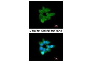 ICC/IF Image Immunofluorescence analysis of methanol-fixed A431, using CLCA1, antibody at 1:200 dilution.