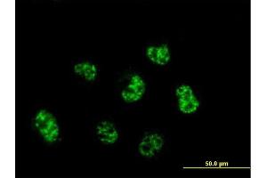Immunofluorescence of monoclonal antibody to C6orf139 on HeLa cell.