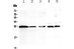 Image no. 1 for anti-Interleukin 1 Family, Member 6 (IL1F6) (AA 6-158) antibody (ABIN5519020)