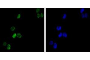 Image no. 1 for anti-GATA Binding Protein 1 (Globin Transcription Factor 1) (GATA1) antibody (ABIN969166)