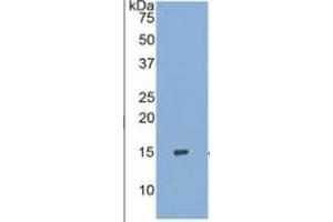Image no. 3 for S100 Calcium Binding Protein A9 (S100A9) ELISA Kit (ABIN6730867)