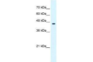 WB Suggested Anti-GLIS3 Antibody Titration:  0.