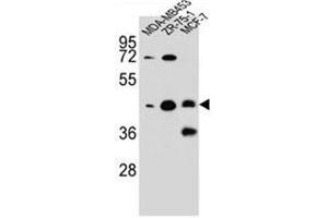 Image no. 1 for anti-Kelch Repeat and BTB (POZ) Domain Containing 13 (KBTBD13) (AA 416-446), (C-Term) antibody (ABIN952689)