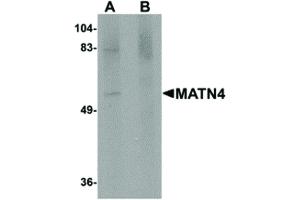 Image no. 1 for anti-Matrilin 4 (MATN4) (N-Term) antibody (ABIN6656461)