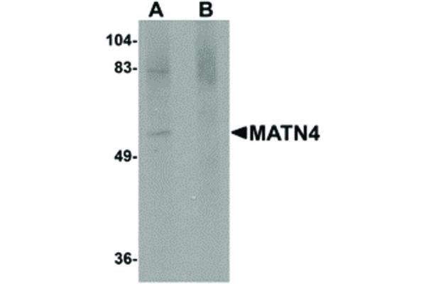 anti-Matrilin 4 (MATN4) (N-Term) antibody