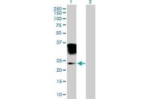 Image no. 1 for anti-Orosomucoid 2 (ORM2) (AA 1-201) antibody (ABIN518545)