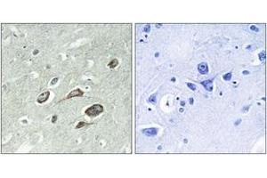 Image no. 2 for anti-Calmodulin 1 (Calm1) (AA 46-95), (pThr79) antibody (ABIN1531529)