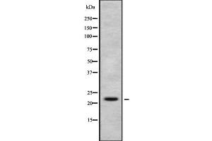 anti-H1 Histone Family, Member X (H1FX) (N-Term) antibody