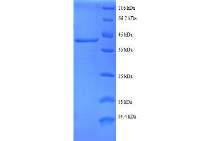 Ribosomal Protein S24 (RPS24) (AA 2-133), (partial) protein (GST tag)