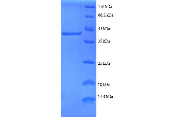 Ribosomal Protein S24 (RPS24) (AA 2-133), (partial) protein (GST tag)