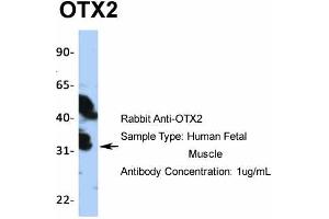 Image no. 6 for anti-Orthodenticle Homeobox 2 (OTX2) (N-Term) antibody (ABIN2779643)