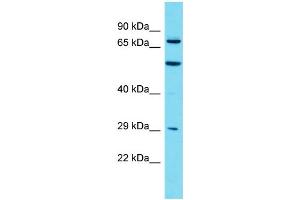 Image no. 1 for anti-Myotubularin Related Protein 7 (MTMR7) (C-Term) antibody (ABIN2790821)