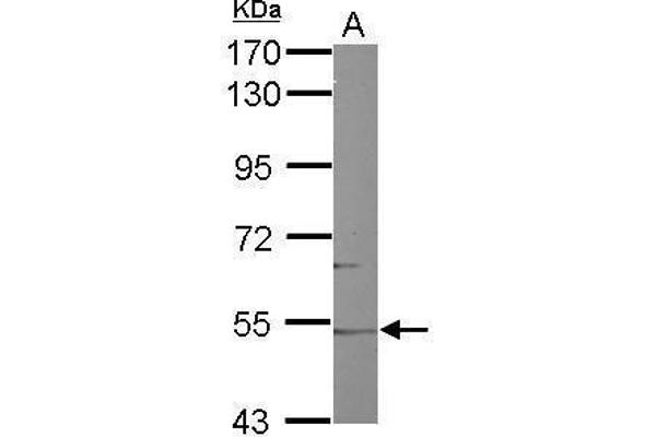 anti-Cytochrome P450, Family 46, Subfamily A, Polypeptide 1 (CYP46A1) (Center) antibody