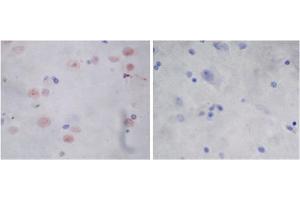 Image no. 2 for anti-Parkinson Protein 2, E3 Ubiquitin Protein Ligase (Parkin) (PARK2) (AA 300-350) antibody (ABIN1574065)
