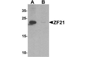 Image no. 1 for anti-Zinc Finger, FYVE Domain Containing 21 (ZFYVE21) (N-Term) antibody (ABIN1449943)