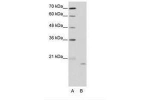 Image no. 1 for anti-Nucleolar Protein 6 (NOL6) (C-Term) antibody (ABIN203026)