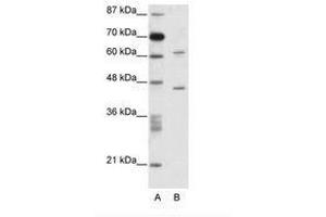 Image no. 1 for anti-TRM1 tRNA Methyltransferase 1-Like (TRMT1L) (AA 61-110) antibody (ABIN6736084)