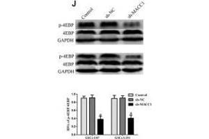 Image no. 3 for anti-Eukaryotic Translation Initiation Factor 4E Binding Protein 1 (EIF4EBP1) antibody (ABIN3021844)