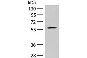 Western blot analysis of Mouse liver tissue lysate using FKTN Polyclonal Antibody at dilution of 1:450