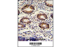 Immunohistochemistry (IHC) image for anti-Chloride Channel, Nucleotide-Sensitive, 1A (CLNS1A) antibody (ABIN2158281)