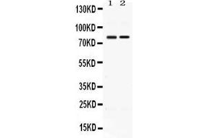 Image no. 2 for anti-Autocrine Motility Factor Receptor (AMFR) (AA 553-643) antibody (ABIN4886455)