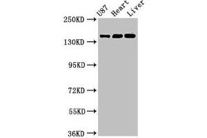 NMDAR2A antibody  (AA 501-750)