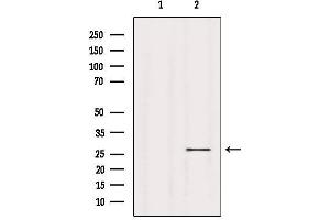Image no. 3 for anti-ASF1 Anti-Silencing Function 1 Homolog B (ASF1B) antibody (ABIN6260075)
