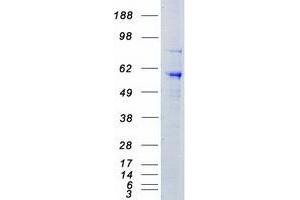 Image no. 1 for serine threonine Kinase 39 (STK39) protein (Myc-DYKDDDDK Tag) (ABIN2712376)