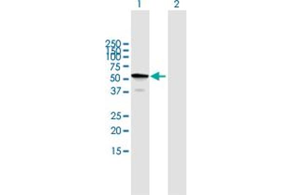 anti-TBC1 Domain Family, Member 22B (TBC1D22B) (AA 1-505) antibody