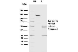 Image no. 1 for anti-Cathepsin D (CTSD) (AA 104-250) antibody (ABIN6939215)