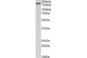 Image no. 3 for anti-Low Density Lipoprotein Receptor-Related Protein 5 (LRP5) (Internal Region) antibody (ABIN185410)