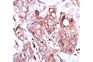 Image no. 1 for anti-V-Erb-A erythroblastic Leukemia Viral Oncogene Homolog 4 (Avian) (ERBB4) (AA 1276-1308) antibody (ABIN3029489)