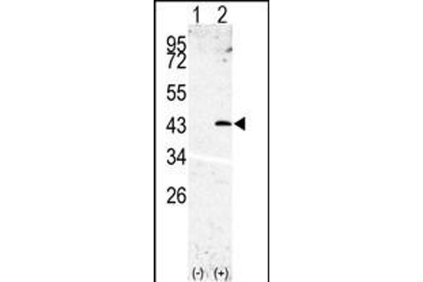 SPPL3 抗体  (N-Term)