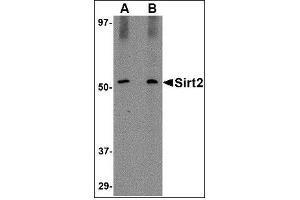 Image no. 4 for anti-Sirtuin 2 (SIRT2) (C-Term) antibody (ABIN615066)